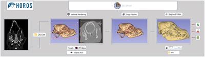 In-house three-dimensional printing for surgical planning: learning curve from a case series of temporomandibular joint and related disorders